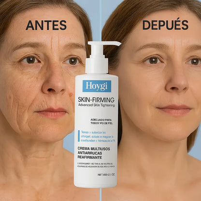 Combo 2x1 - Crema Reafirmante Hoygi